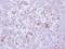 Matrix Metallopeptidase 13 antibody, NBP2-17310, Novus Biologicals, Immunohistochemistry paraffin image 