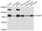 Toll Like Receptor Adaptor Molecule 1 antibody, STJ25850, St John