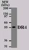 TNF Receptor Superfamily Member 10a antibody, NB100-56747, Novus Biologicals, Western Blot image 