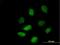 Histone Deacetylase 9 antibody, H00009734-B01P, Novus Biologicals, Immunofluorescence image 