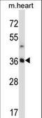 Stanniocalcin 2 antibody, LS-C161553, Lifespan Biosciences, Western Blot image 