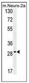 Olfactory Receptor Family 9 Subfamily Q Member 1 antibody, AP53114PU-N, Origene, Western Blot image 