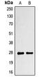 Paired Related Homeobox 1 antibody, MBS820145, MyBioSource, Western Blot image 