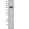 ADAM Metallopeptidase With Thrombospondin Type 1 Motif 1 antibody, abx147986, Abbexa, Western Blot image 