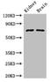 Glucosidase Alpha, Acid antibody, orb41825, Biorbyt, Western Blot image 