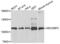 SECIS Binding Protein 2 antibody, PA5-77008, Invitrogen Antibodies, Western Blot image 