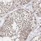 Nucleoporin 153 antibody, PA5-55721, Invitrogen Antibodies, Immunohistochemistry frozen image 