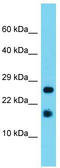 Gamma-Glutamylamine Cyclotransferase antibody, TA331641, Origene, Western Blot image 