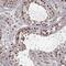 TATA-Box Binding Protein Associated Factor 13 antibody, PA5-60728, Invitrogen Antibodies, Immunohistochemistry paraffin image 