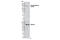 ALK Receptor Tyrosine Kinase antibody, 12127S, Cell Signaling Technology, Western Blot image 