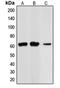Checkpoint Kinase 2 antibody, MBS821138, MyBioSource, Western Blot image 