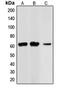 Checkpoint Kinase 2 antibody, MBS821138, MyBioSource, Western Blot image 