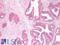 FAP antibody, LS-A8027, Lifespan Biosciences, Immunohistochemistry paraffin image 