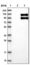 TNFRSF21 antibody, NBP1-84982, Novus Biologicals, Western Blot image 