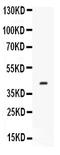 Complement Factor D antibody, PB9850, Boster Biological Technology, Western Blot image 