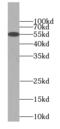 C9orf72-SMCR8 Complex Subunit antibody, FNab01149, FineTest, Western Blot image 