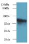 Zinc Finger DHHC-Type Containing 4 antibody, MBS1493267, MyBioSource, Western Blot image 