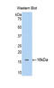 Fibroblast Growth Factor Receptor 1 antibody, LS-C293919, Lifespan Biosciences, Western Blot image 