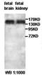 Small G Protein Signaling Modulator 1 antibody, orb77611, Biorbyt, Western Blot image 