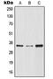NFKB Inhibitor Alpha antibody, MBS820453, MyBioSource, Western Blot image 