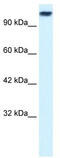 Kinesin Family Member 3C antibody, TA334685, Origene, Western Blot image 