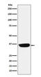 Paired Like Homeobox 2B antibody, M02221, Boster Biological Technology, Western Blot image 