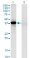 Sorbitol Dehydrogenase antibody, H00006652-M03, Novus Biologicals, Western Blot image 