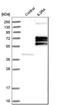 Interleukin 3 Receptor Subunit Alpha antibody, HPA003539, Atlas Antibodies, Western Blot image 