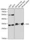 Tissue Factor Pathway Inhibitor antibody, GTX16395, GeneTex, Western Blot image 