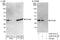 OTU Deubiquitinase, Ubiquitin Aldehyde Binding 1 antibody, A302-918A, Bethyl Labs, Immunoprecipitation image 