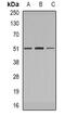 Interleukin 1 Receptor Associated Kinase 4 antibody, abx141818, Abbexa, Western Blot image 