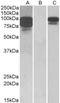 Proprotein Convertase Subtilisin/Kexin Type 9 antibody, PA5-19073, Invitrogen Antibodies, Western Blot image 