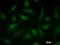 SATB Homeobox 1 antibody, LS-C342734, Lifespan Biosciences, Immunofluorescence image 