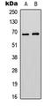 Epsin 3 antibody, LS-C358745, Lifespan Biosciences, Western Blot image 