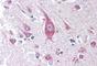 Inducible T Cell Costimulator Ligand antibody, NBP1-39919, Novus Biologicals, Immunohistochemistry frozen image 