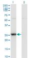 Thymidine Kinase 1 antibody, H00007083-M07, Novus Biologicals, Western Blot image 