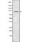 Suppression Of Tumorigenicity 14 antibody, abx218776, Abbexa, Western Blot image 