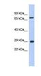 AKT Interacting Protein antibody, NBP1-53106, Novus Biologicals, Western Blot image 