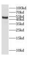 Cholesterol side-chain cleavage enzyme, mitochondrial antibody, FNab02143, FineTest, Western Blot image 