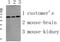 Phospholipase D Family Member 4 antibody, STJ99651, St John