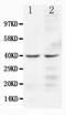 C-C Motif Chemokine Receptor 5 (Gene/Pseudogene) antibody, PA5-78949, Invitrogen Antibodies, Western Blot image 