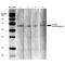 Synaptotagmin 6 antibody, MA5-27599, Invitrogen Antibodies, Western Blot image 