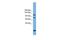 Protein Phosphatase 6 Regulatory Subunit 1 antibody, PA5-44275, Invitrogen Antibodies, Western Blot image 