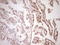 Tissue Factor Pathway Inhibitor antibody, LS-C790769, Lifespan Biosciences, Immunohistochemistry paraffin image 