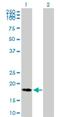 Caspase Recruitment Domain Family Member 19 antibody, H00084270-B01P, Novus Biologicals, Western Blot image 