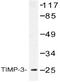 TIMP Metallopeptidase Inhibitor 3 antibody, AP20507PU-N, Origene, Western Blot image 