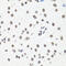 Histone Cluster 1 H2B Family Member I antibody, A16595-1, Boster Biological Technology, Immunohistochemistry paraffin image 