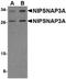 Nipsnap Homolog 3A antibody, PA5-20657, Invitrogen Antibodies, Western Blot image 