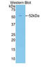 Apelin antibody, LS-C373078, Lifespan Biosciences, Western Blot image 