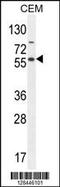 NFKB Inhibitor Like 1 antibody, 55-337, ProSci, Western Blot image 